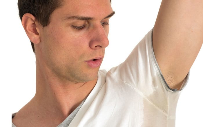 excessive sweating treatment